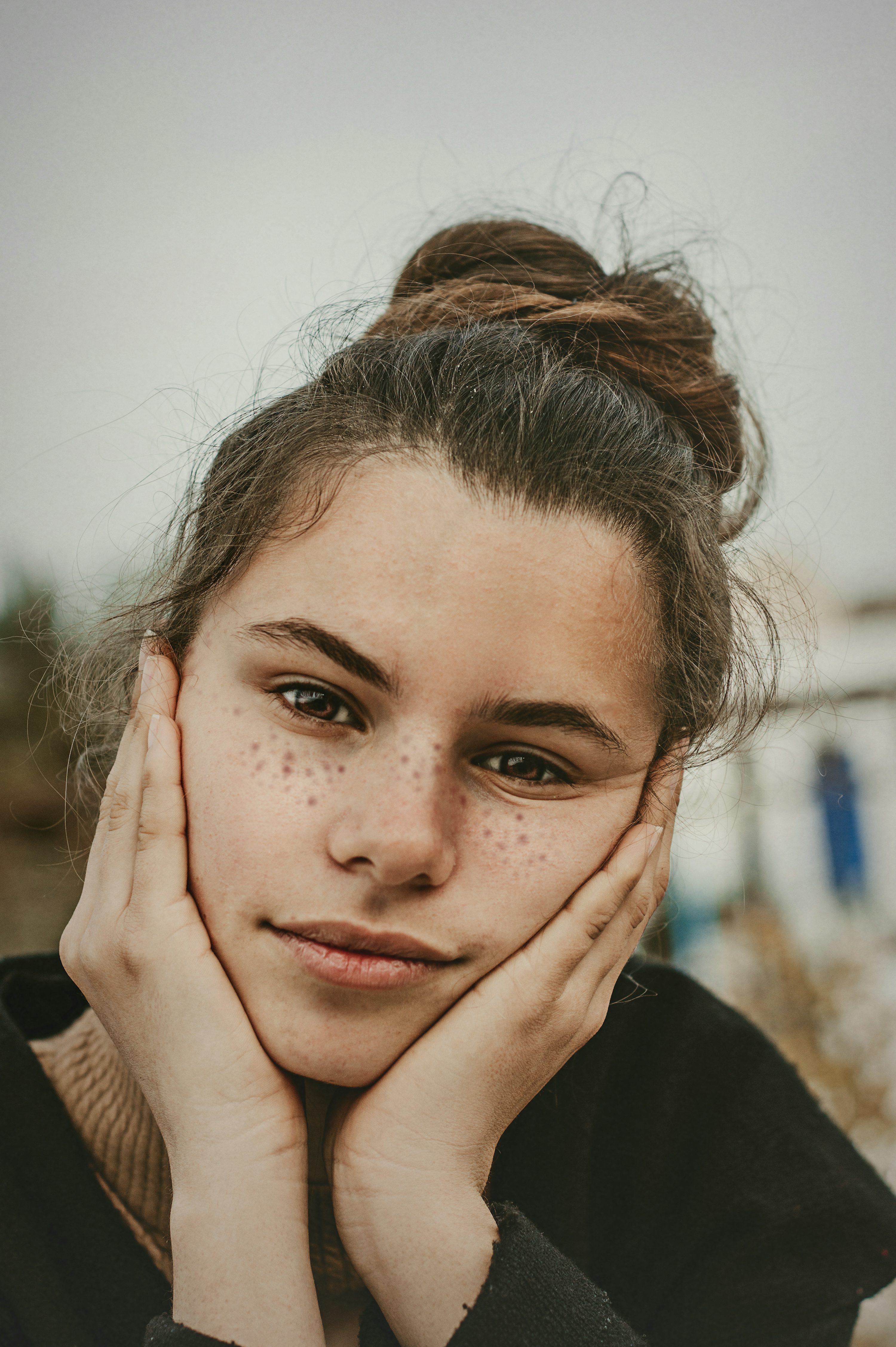 여드름 흉터 연고