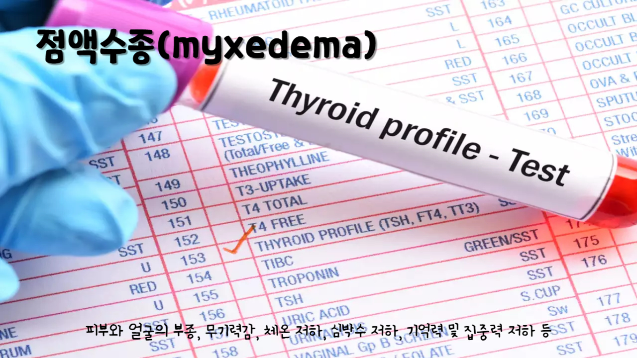점액수종(myxedema)
점액수종 주요 증상 : 피부와 얼굴의 부종, 무기력감, 체온 저하, 심박수 저하, 기억력 및 집중력 저하 등