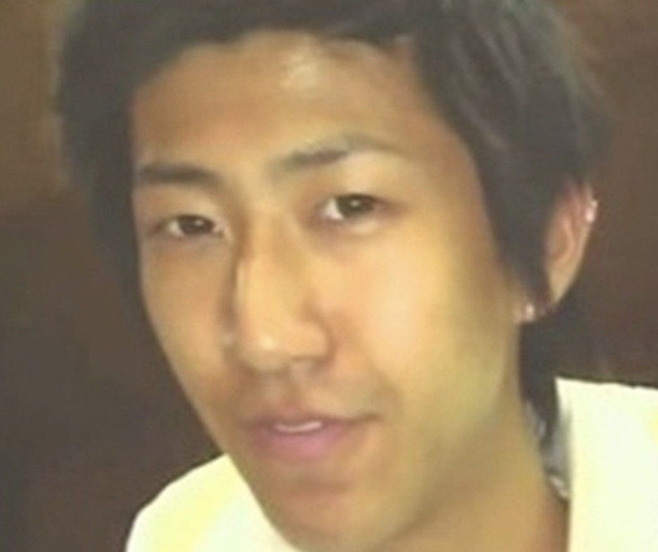 광희 성형 전