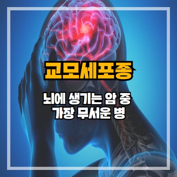 교모세포종, 가장 치명적인 뇌종양… 증상과 생존율이 다릅니다
