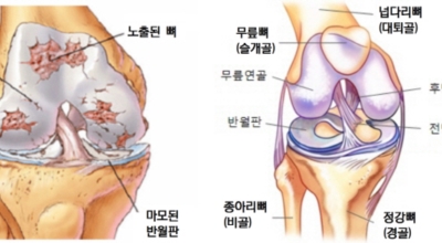 무릎 이미지