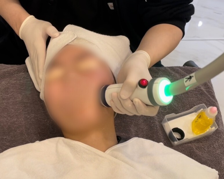 온다 리프팅 후기