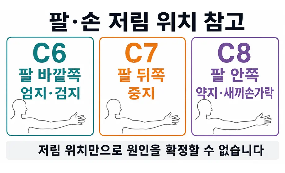 C6 C7 C8 신경에 따른 팔과 손가락 저림 위치 비교