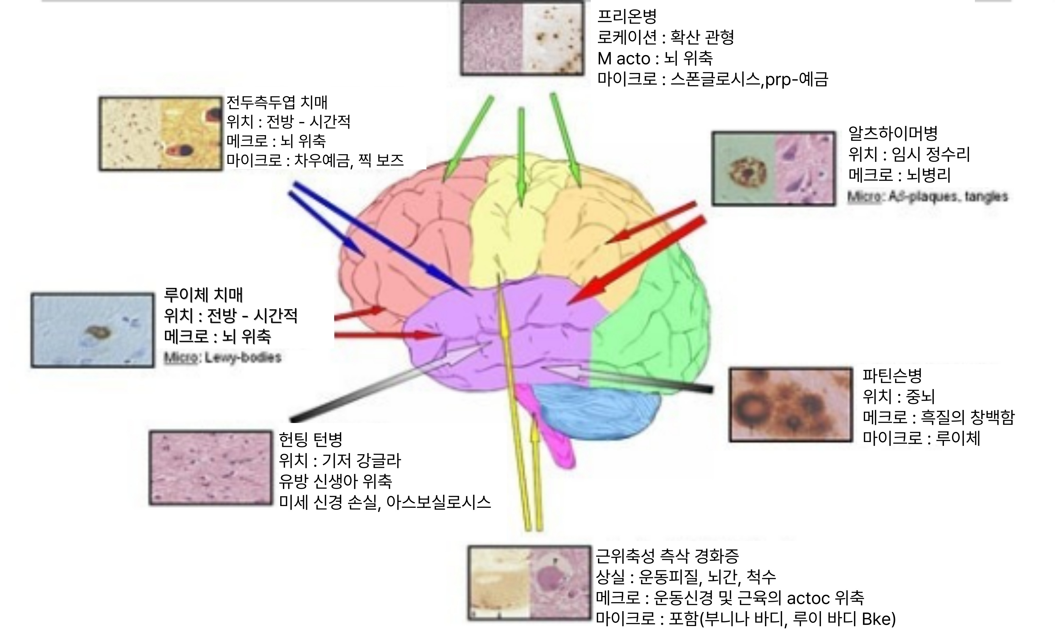 신경퇴행성 질환 단백질 데이터세트 공개 관련 이미지