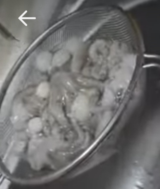 How to Make Nakji Yeonpotang (Octopus Soup) image