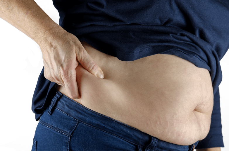 대사증후군 뜻, 비만한 복부