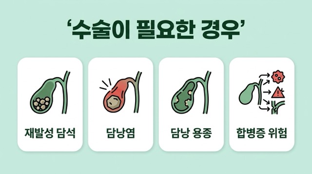담석증 담낭염 오른쪽 윗배 통증 수술 필요성