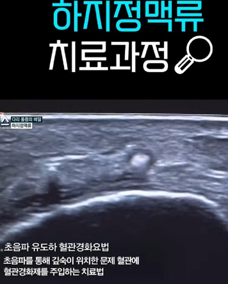 명의-박기혁-교수-다리-혈관-질환