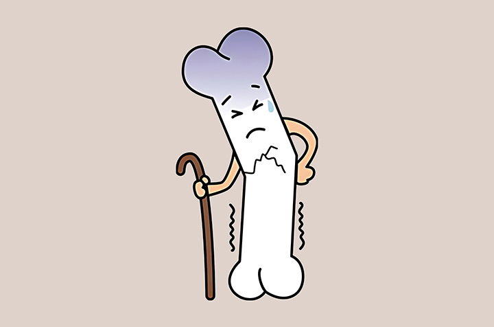주저앉은-자세로-변형된-뼈-모습