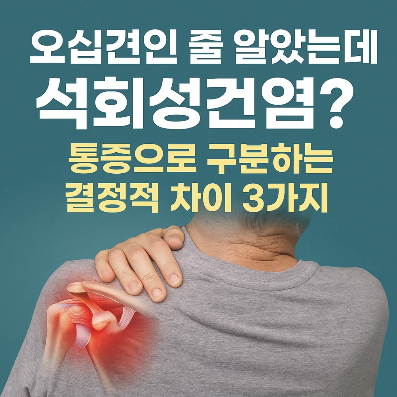 오십견인 줄 알았는데 석회성건염? 통증으로 구분하는 결정적 차이 3가지