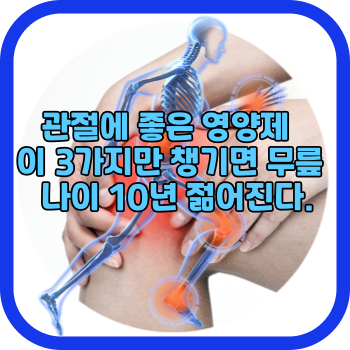 관절에 좋은 영양제 이 3가지만 챙기면 무릎 나이 10년 젊어진다.