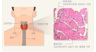 갑상선 이미지