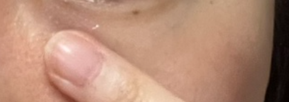 유쎄라블 리프팅 900샷 아이크림 효과