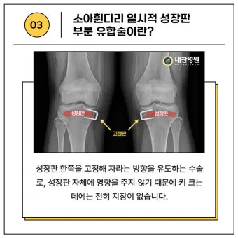 성장판 닫혀도 키 클 수 있는 방법과 성장 호르몬 시기_9
