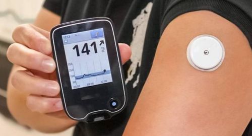 연속 혈당측정기 부착 모습(사진 : Pinterest)
