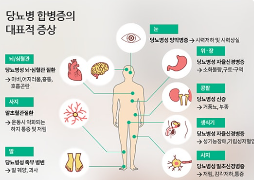 고혈압과 당뇨병의 동시 발병 관련 이미지