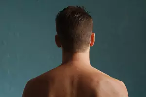 거북목 증후군 예방법