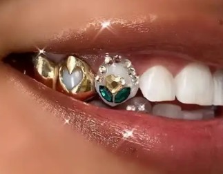 투스젬 부착방법, 유지기간, 부작용, 가격