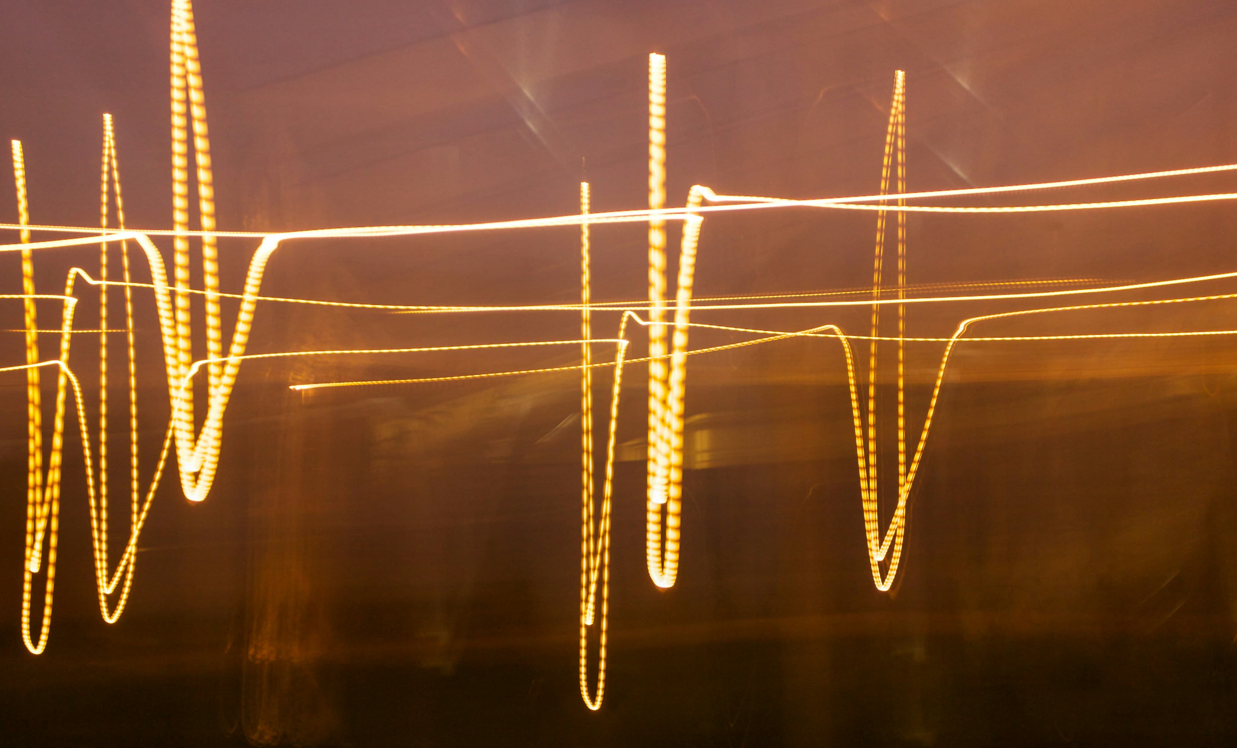 음악 치료로 불안증을 극복하는 5가지 방법