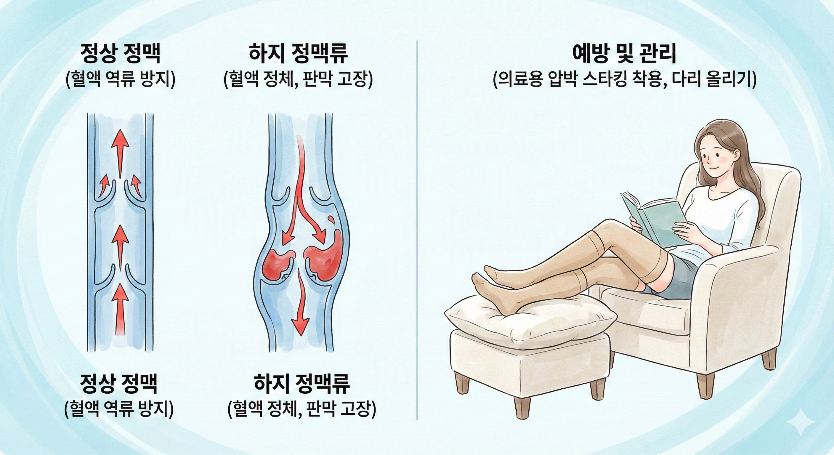 이 이미지는 정상 정맥과 하지 정맥류의 차이를 판막 기능과 혈액 흐름을 통해 직관적으로 비교하고, 의료용 압박 스타킹 착용과 다리 올리기와 같은 구체적인 예방 및 관리 방법을 제시하여 하지 정맥류에 대한 이해를 돕는 교육적인 목적을 가진 이미지