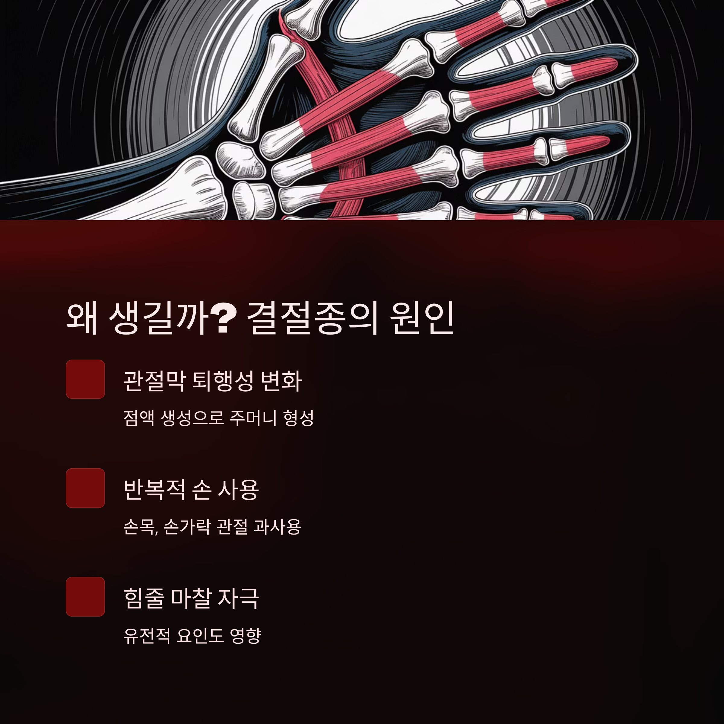 결절종의 원인으로 관절막 변화, 손 과사용, 유전적 영향 등을 설명한 해부학적 이미지