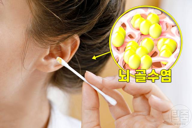 귀에 물 들어가면 귀 통증 염증 외이도염 중이염
