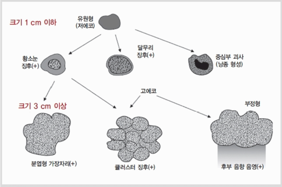 전이성 간암의 크기에 따른 종괴형태의 변화