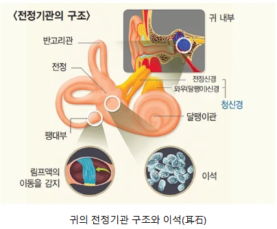 이석증의 증상과 자기치료법