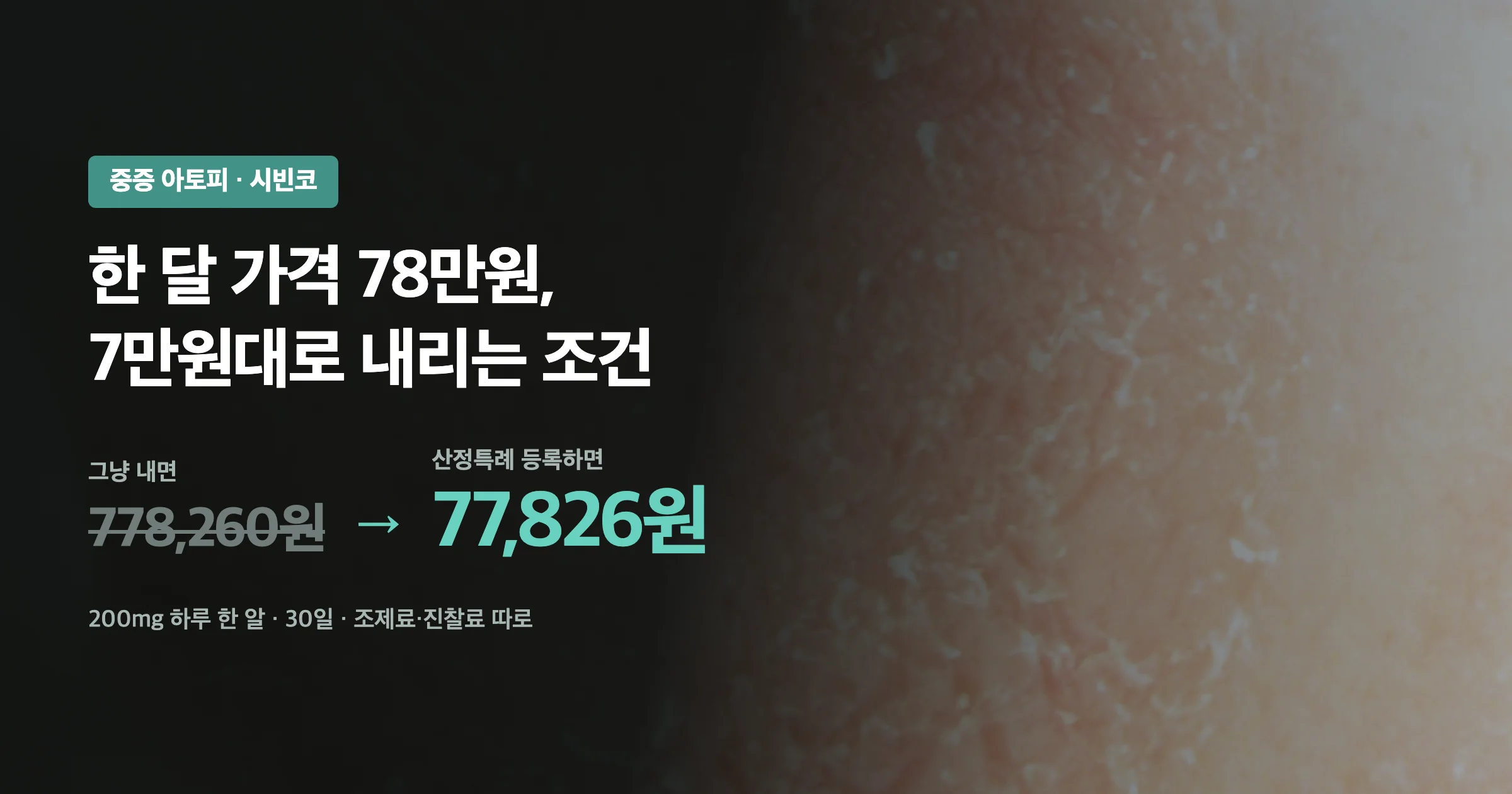 시빈코 한 달 약값 778,260원이 산정특례 등록으로 77,826원이 된다는 요약 이미지