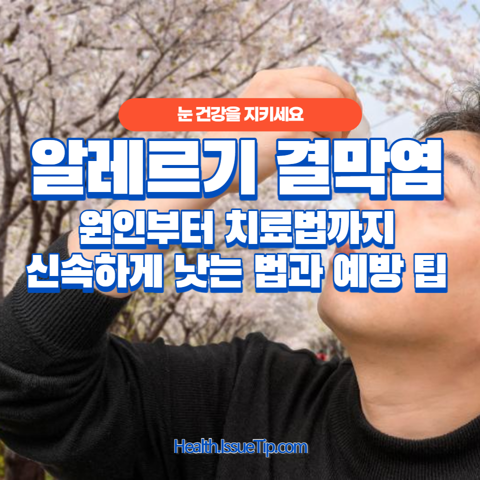 알레르기 결막염의 원인부터 치료법까지