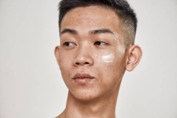 염증성색소침착 염증성 색소침착 여드름 자국 모낭염 PIH 흉터 크림 치료 증상 cream 뜻 레이저 피부 효과 피부과 검사 없애는법 약 시술 제거