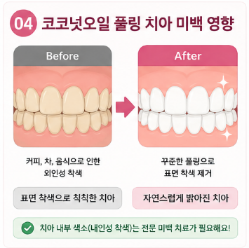 코코넛오일-효과-하는법-부작용-치아-미백-영향