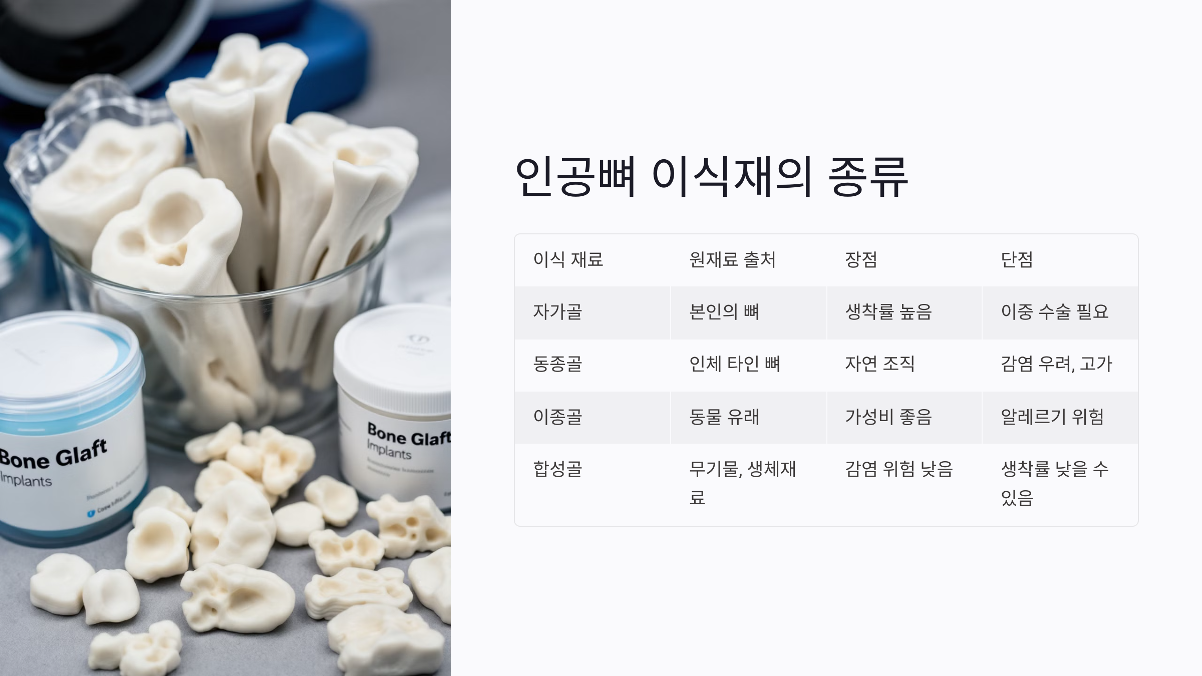 인공뼈 이식재의 종류와 특성 비교