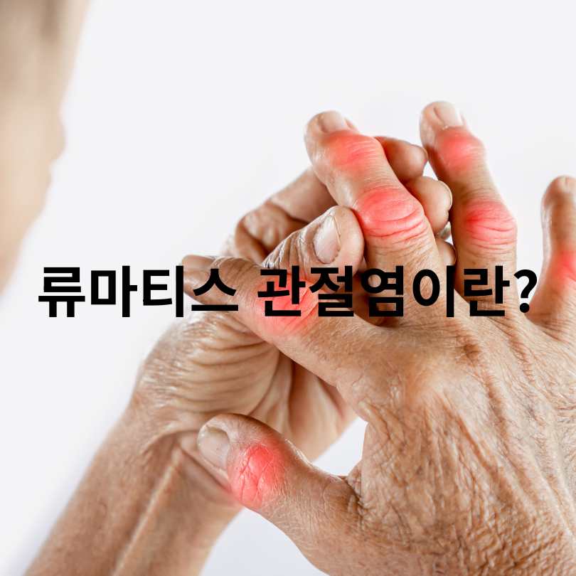 퇴행성 관절염과 류마티스 관절염의 차이점