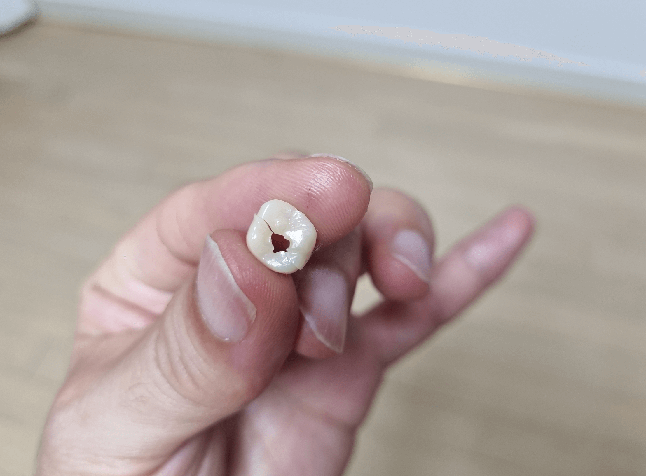 지르코니아 크라운 가격