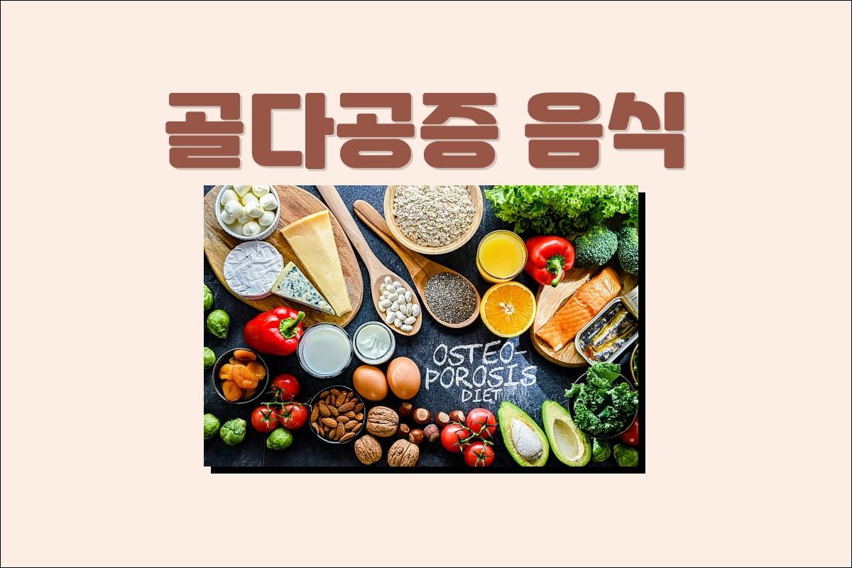 골다공증 음식 좋은 음식 안좋은 음식