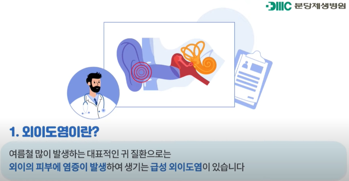 외이도염 치료 방법은? 연고와 약, 병원치료 차이점 비교