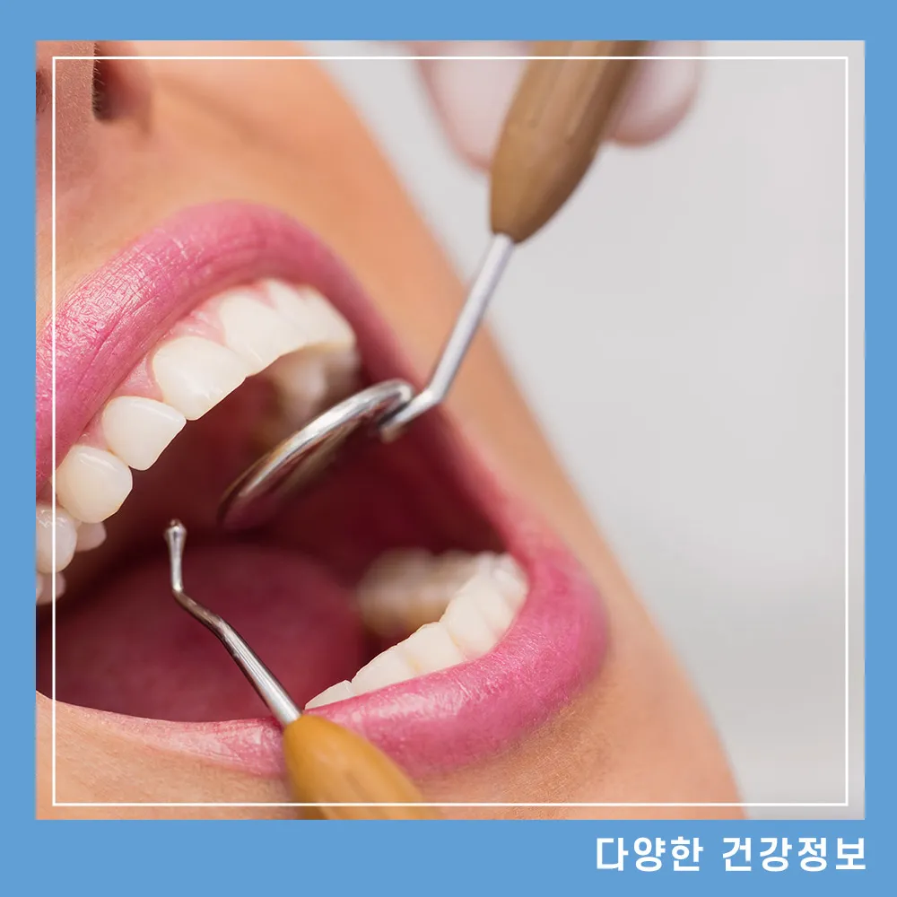 풍치 증상 원인