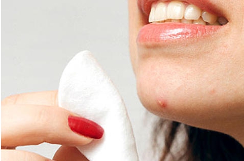 부위별 여드름 원인