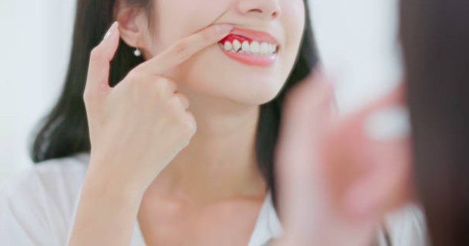 잇몸 내려앉는 원인