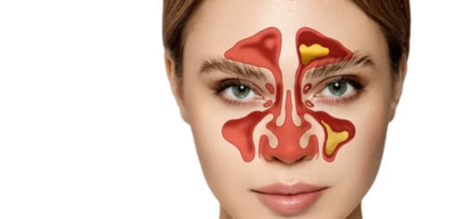 비인두암의 생존율