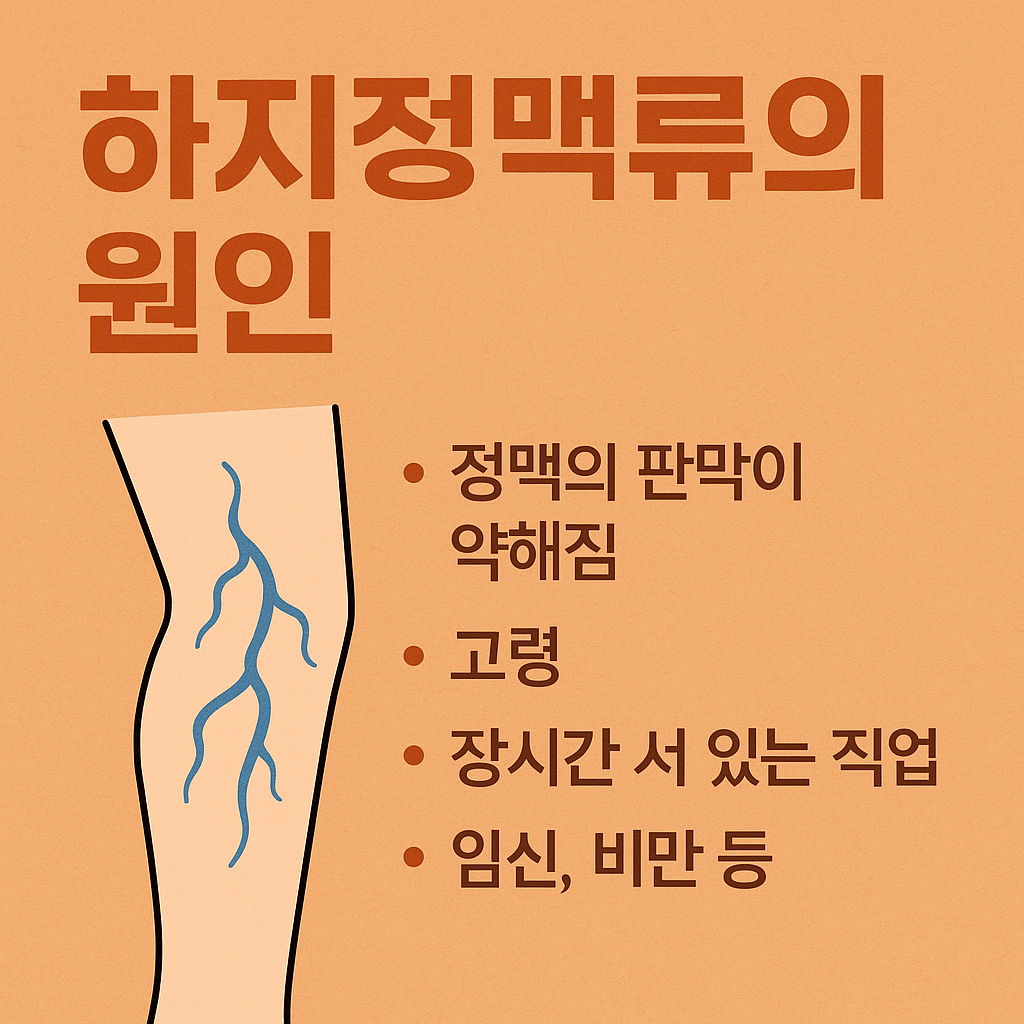 하지정맥류