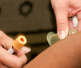 고지혈증 치료법 진단기준 예방