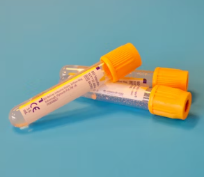 빈혈 증상 원인 치료 방법