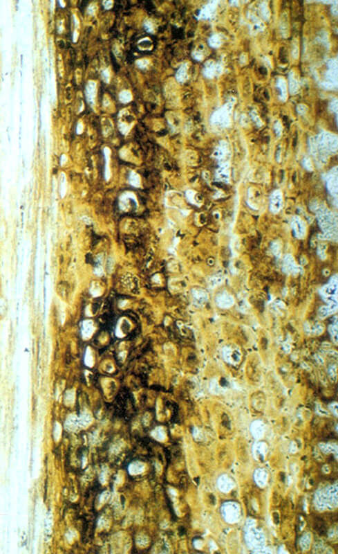 고사리의-조상-나무고사리