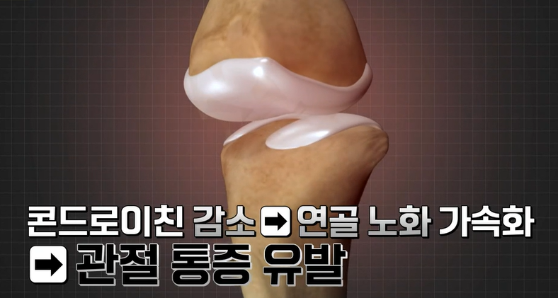 콘드로이친