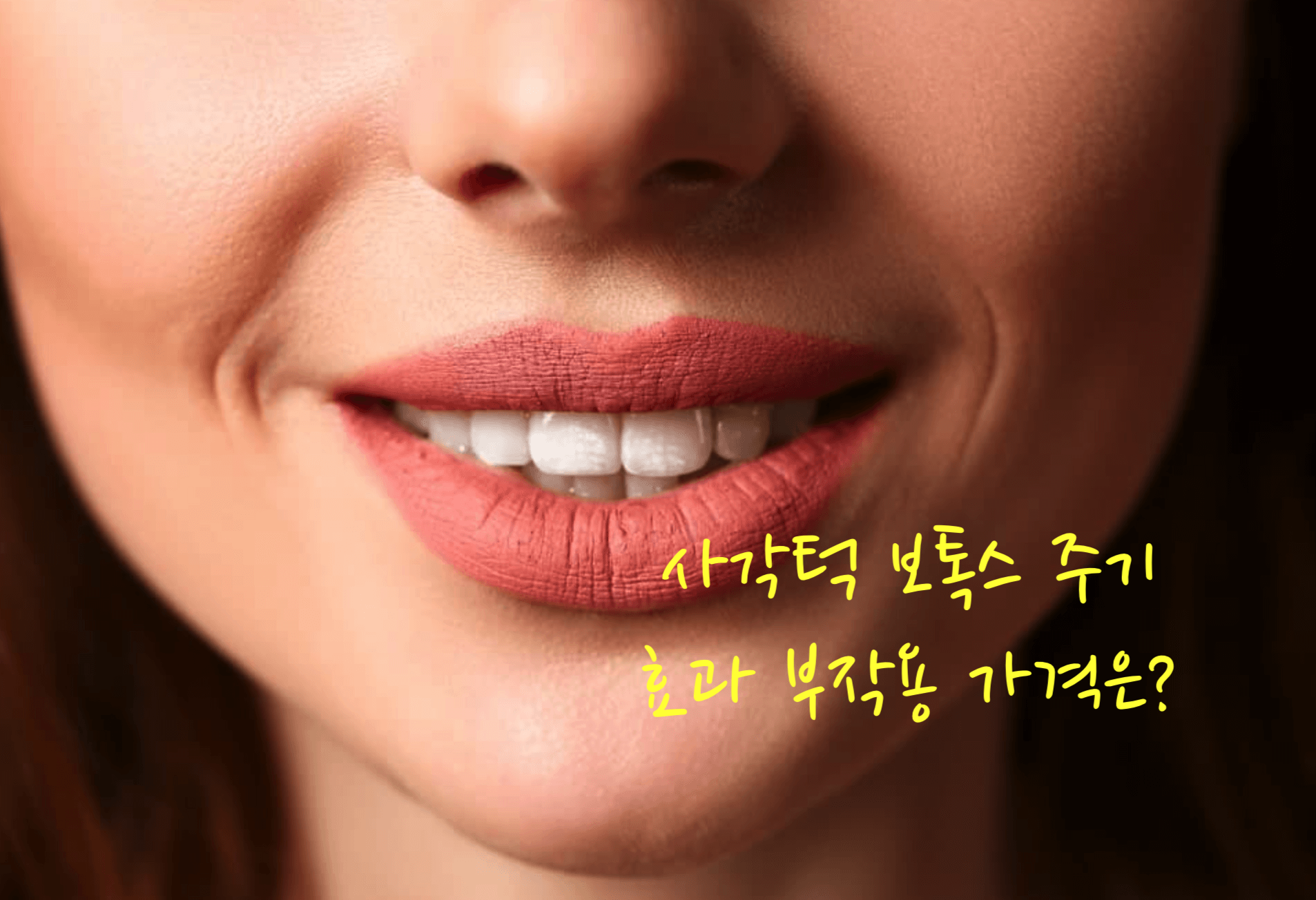 사각턱 보톡스