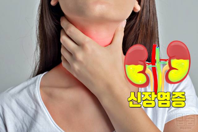 신장 나쁜 습관 독감 편도선염