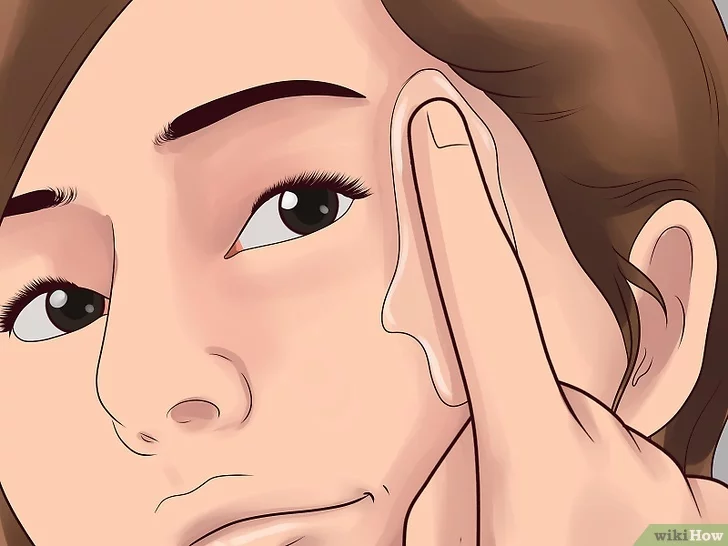 기미 잡티 제거