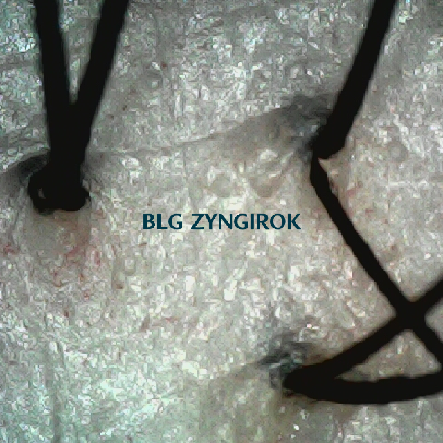 피나모아 복용 23주차 - 뒷머리 두피 모습이다.